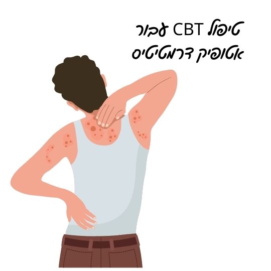 אטופיק דרמטיטיס CBT