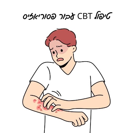 טיפול CBT עבור פסוריאזיס